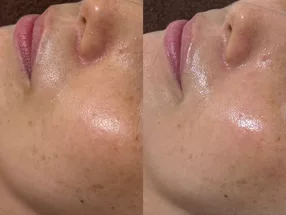 천사의 윤기 피부 니시신주쿠점 2