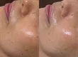 Angel Gloss Skin Facial & Head Spa Nishishinjuku 2